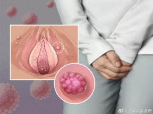 女幸尿道口摸起来有点小疙瘩，可能是感染了 HPV 病毒