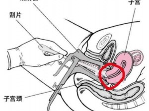 女性妇科检查原因揭秘：医院偷拍背后的秘密