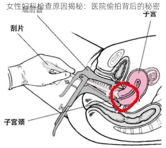 女性妇科检查原因揭秘：医院偷拍背后的秘密